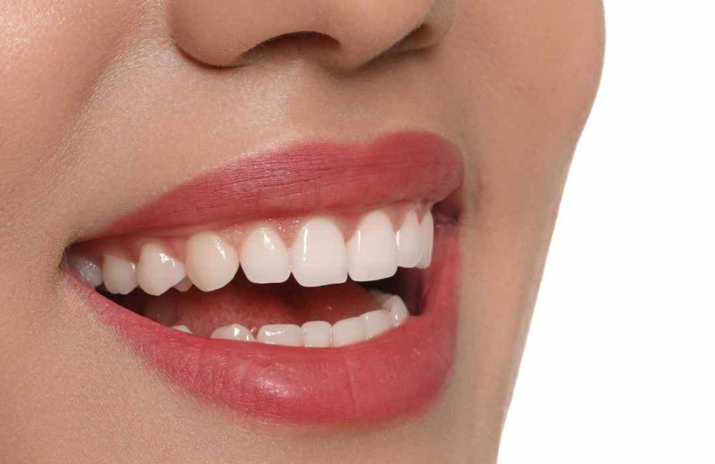 שיניים אחרי