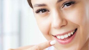 הלבנת שיניים