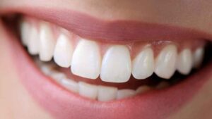 שיניים יפות