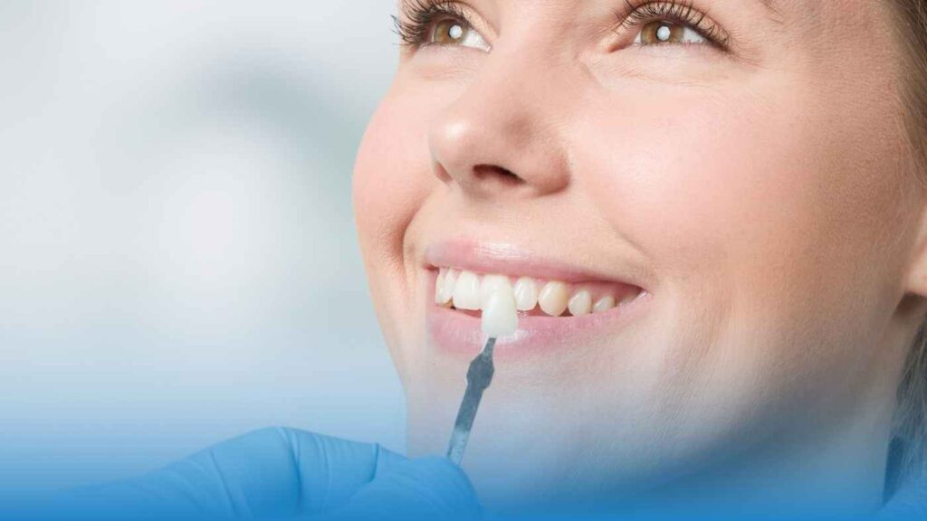 ציפוי שינים למינייט ירושלים